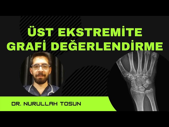 Üst Ektremite Grafi Nurullah Tosu