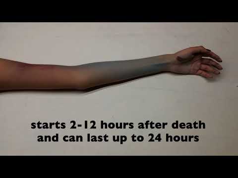 Stages Of A Body After Death