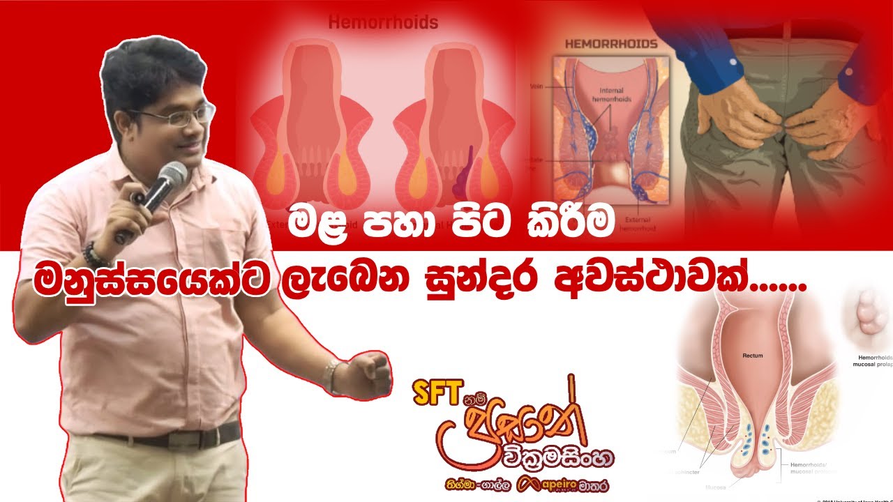මොකද්ද මේ අර්ශස් කියන්නේ? #hemorrhoids  #Treatment #Arshas