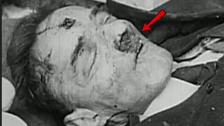 Hitler Ordered His Body Burned — Until Only Dental Records Could Identify Him