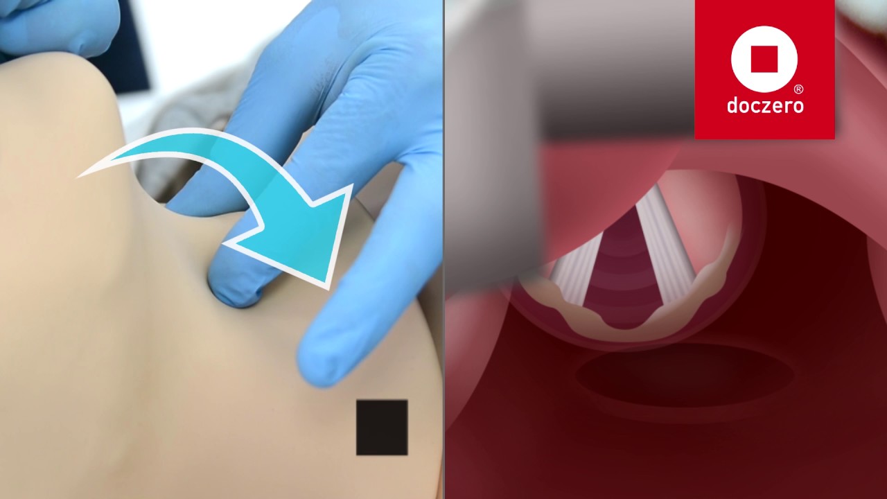 BURP Techniek | Doczero E-learning