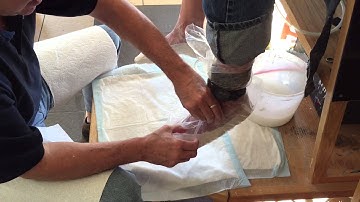 How Custom Foot Orthotics Are Made