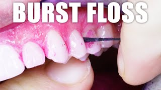 Dentist Reviews The Best Floss For Teeth Cleaning Use Burst Floss For Plaque And Tartar Removal
