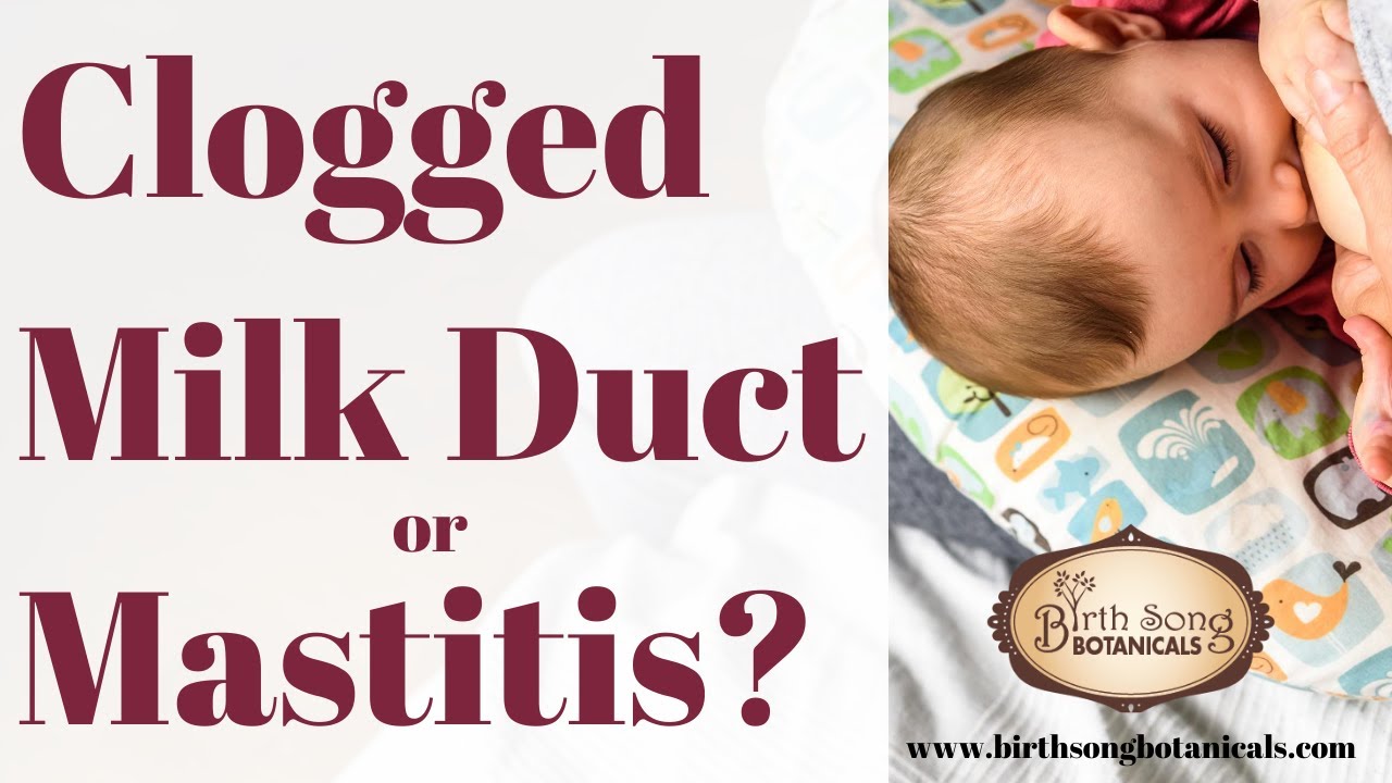 How to Treat A Clogged Milk Duct and Prevent Mastitis Breastfeeding