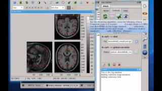 NRAD denoising in AMILab