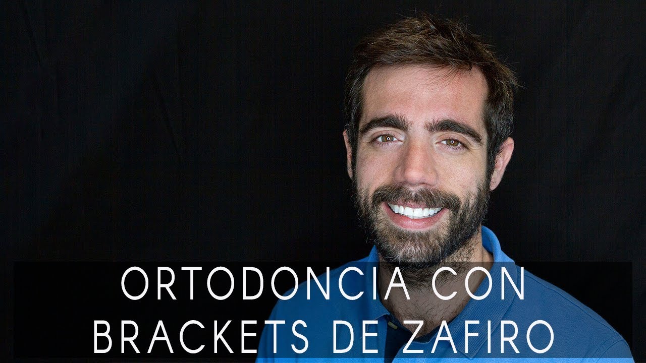 La sonrisa de Michael su experiencia con brackets de zafiro y