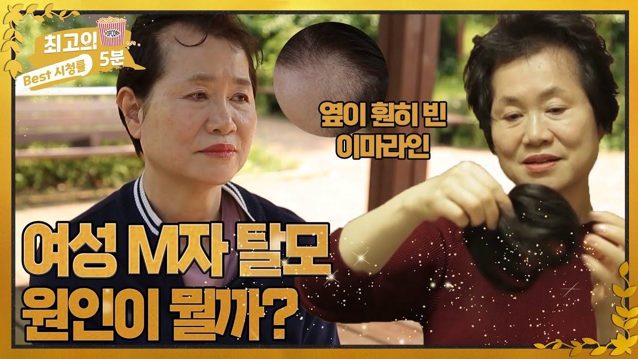 [최고의 5분_내 몸을 바꾸는 시간] 여성 M자 탈모, 원인이 뭘까? MBN 220612 방송