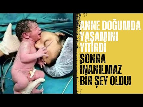 Anne, Doğum Sırasında Yaşamını Yitirdi. O Sırada İnanılmaz Bir Şey Oldu!