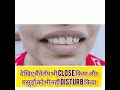 दांतों के गॅप को कैसे कम करें Diastema closure