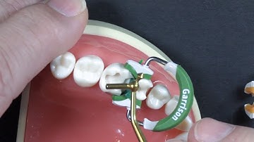 Top 5 Questions: #2 | Extra Wide Prep