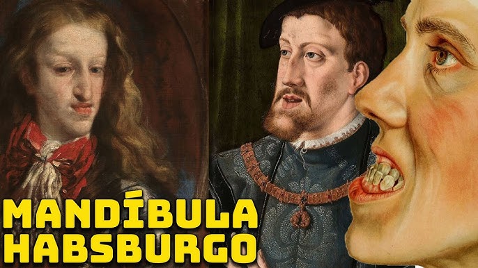 A Mandíbula Habsburgo: O Horror Genético da Dinastia Habsburgo