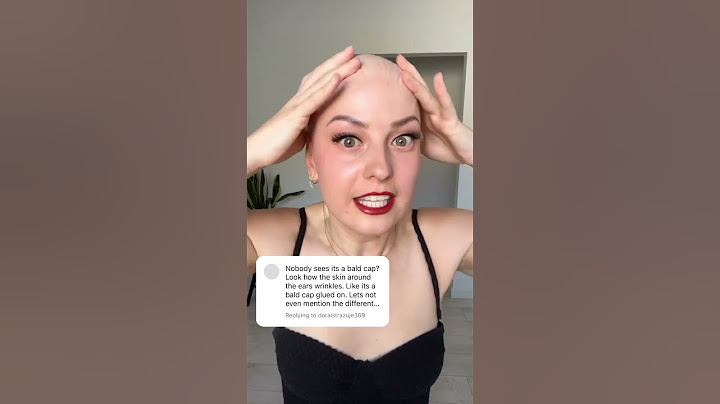 👩🏻‍🦲👩🏻‍🦲👩🏻‍🦲 #bald #alopecia #hairloss #wigs #balding #losinghair #hairlosssolution