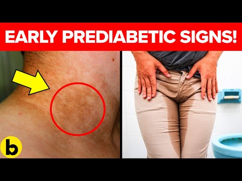 7-warning-signs-that-you-are-prediabetic