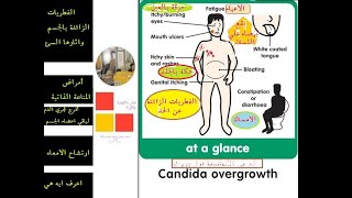 مش دكتورة ولكن - داء #الكانديدا او #المبيضات / #الفطريات_الزائدة Candida_overgrowth#