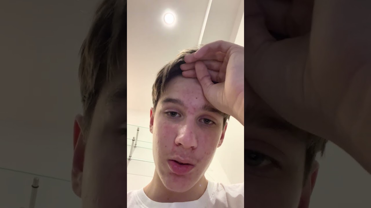 Day 770 getting Rick rolled everyday until Rick Astley Comments on my video