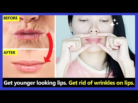 Get younger looking lips!! How to get rid of wrinkles on lips, around mouth, upper lip wrinkles.