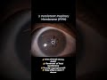Don't miss this in OPD #doctor #optometry #medical
