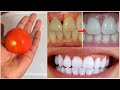 علاج الطماطم في 5 دقائق لتبييض الأسنان طبيعيا في المنزل 