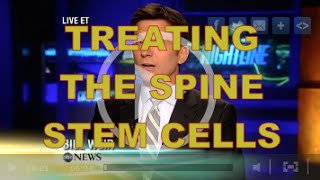 Chiropractor Gets PRP injections for Chronic Back Pain from Arthritis