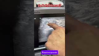 ปวดข้อเท้าเรื้อรัง สาเหตุ?