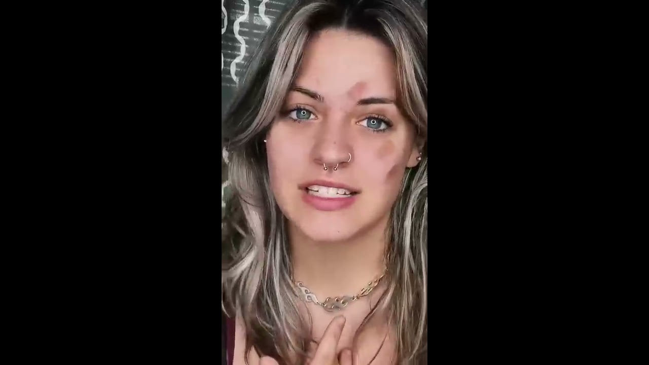  Pov Every Time You Touch Your Face It Leaves A Mark Shorts Tiktok Acting
