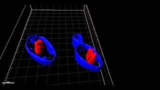 Yeast-deconvolution and surface rendering Wealth