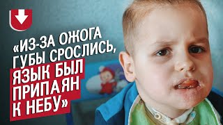 Мой сын выпил кислоту: Катя | Быть мамой