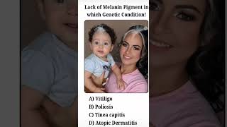 Melanin Loss in VITILIGO |EXPLAINED IN DESCRIPTION BOX #vitíligo #medicalnotes #neetmdspreparation