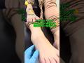 Can’t Squat?Check your Midfoot! 🦶💥标题:蹲不下去检查一下你的“中足”!