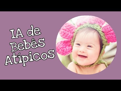 Bebe con sindrome de down prematuro