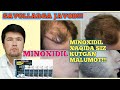 #minoxidil #soch #soqol | MINOXIDIL XAQIDA SIZ KUTGAN VIDEO , SAVOLLARGA JAVOBLAR . TO'LIQ VIDEO !!!