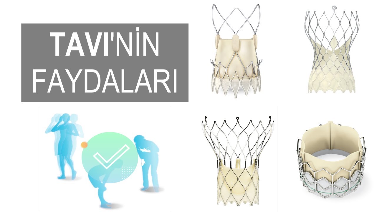 TAVI Procedure 9 TAVI Procedure