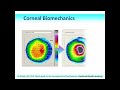 Quick Guide to the Management of Keratoconus: Part 1