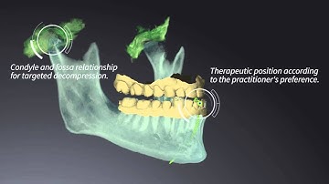 SICAT Function: Track real motion in motion.