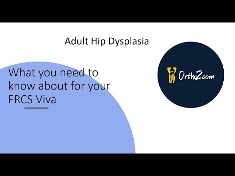 Video: Što trebate znati o hip displazija