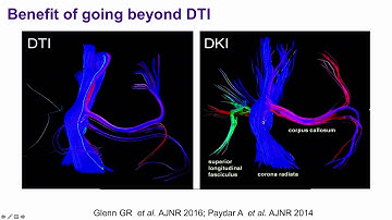 Diffusion MRI to assess brain microstructure. Els Fieremans, PhD