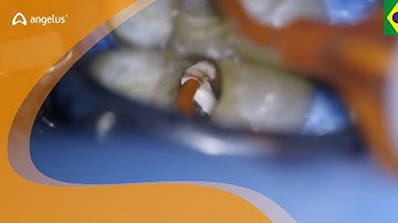 BIO-C® SEALER | Prof. Dr. Charles Pereira