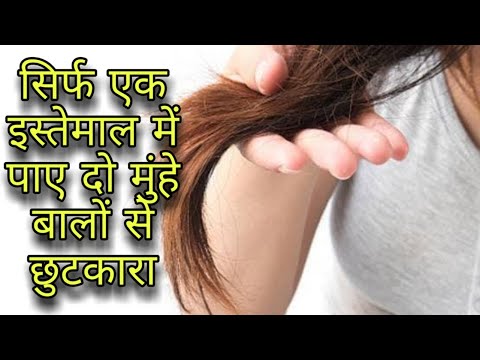 वीडियो: डर्माबॉन्ड कैसे लगाएं (चित्रों के साथ)