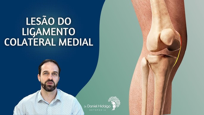 3 Formas de Fortalecer o Ligamento Colateral Medial (LCM)