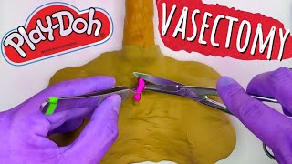 Male Vasectomy Procedure Using Play-Doh Model | Step By Step