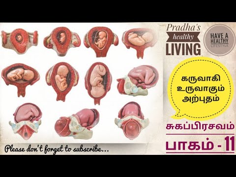 கரு உருவான நாள் முதல் பிறக்கும் வரை குழந்தையின் வளர்ச்சி நிலை...  சுகப்பிரசவம் (பாகம் 11)