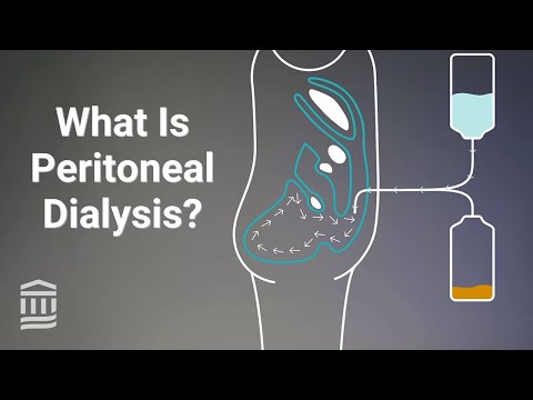Video: Když peritoneální dialýza přestane fungovat?