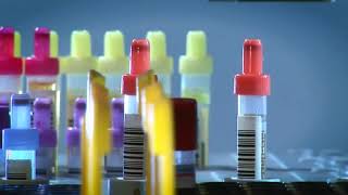 Sarstedt Laboratory Automation