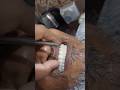 #dental care#dentist # tiktok video #sylhet #doctor 😮
