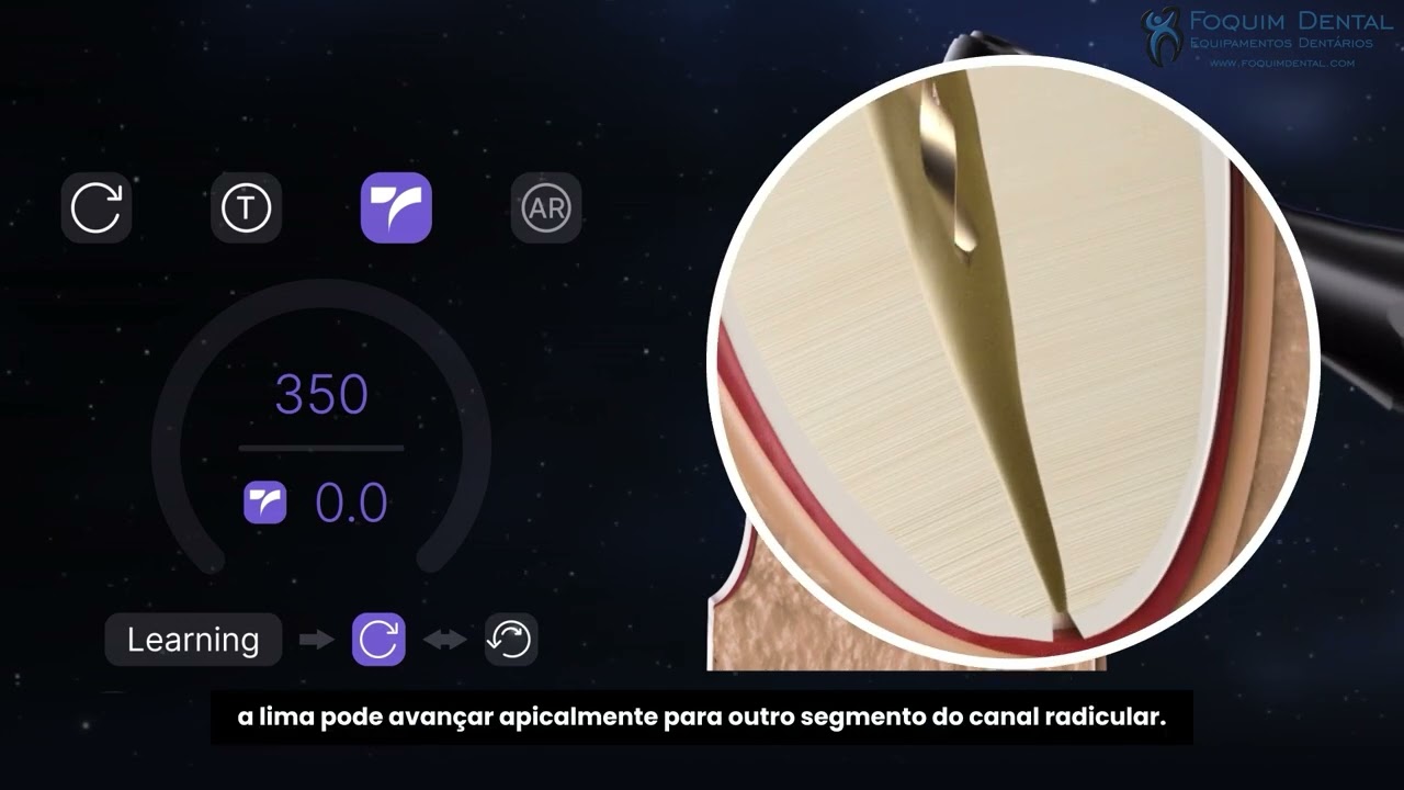 Woodpecker Endo GT TorqueSense