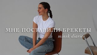 влог седьмой | мне поставили брекеты!