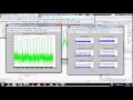 ECG Signal Processing in MATLAB - Detecting R-Peaks