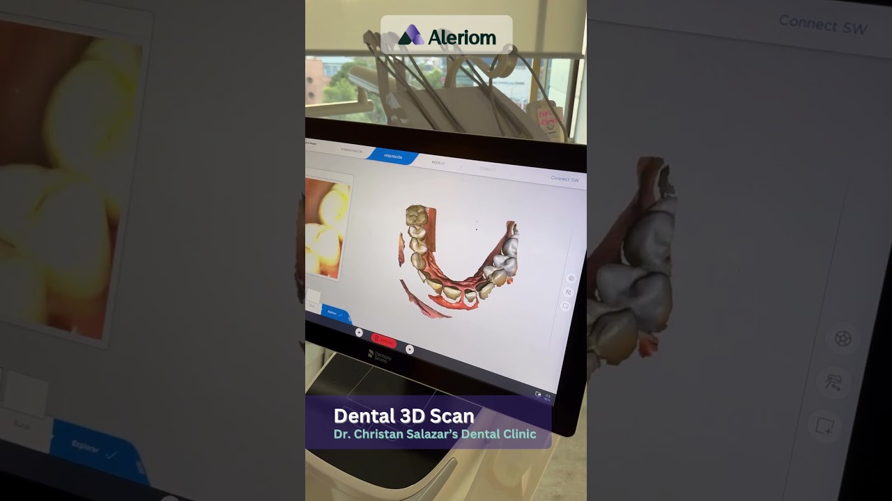 3D Dental Scanner  