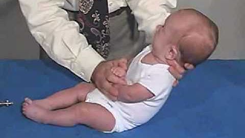 Neurology Exam, 3 Month: Primitive Reflexes-Moro