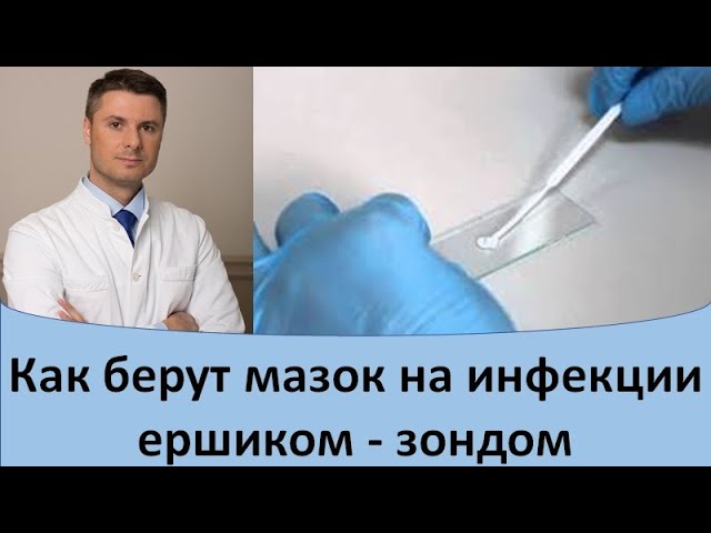 как взять мазок у мужчины на инфекцию